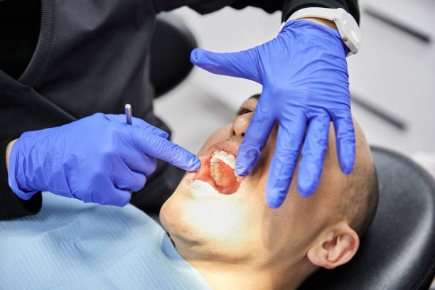 Best Emergency Root Canal Therapy in Plainville, KS
